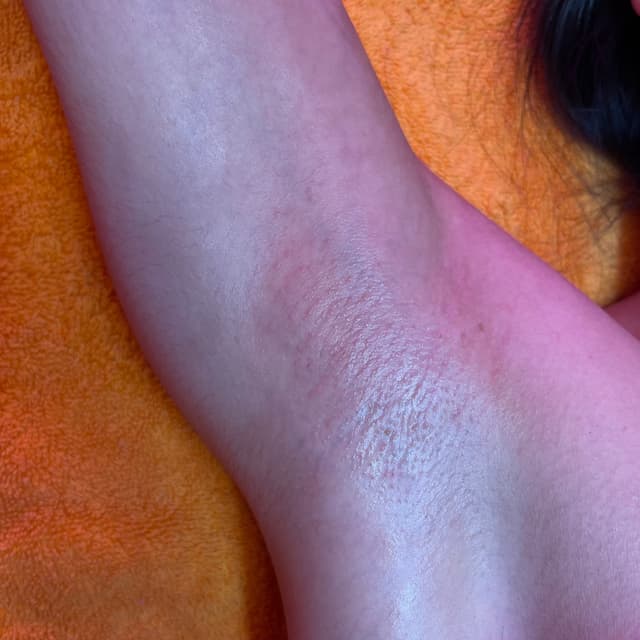 Underarm Sugaring Pass 🌟 at Aliign Spa in Cypress, CA